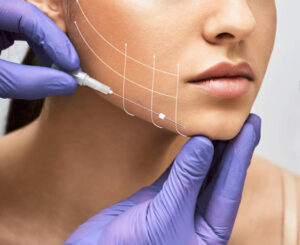 What Should Be Assessed Before Jawline Filler in Dubai?