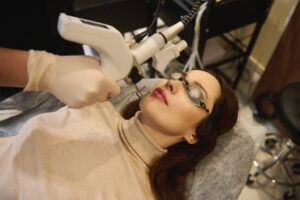 How Long Does Skin Take to Heal After Fractional Laser Treatment? 1 How Long Does Skin Take to Heal After Fractional Laser Treatment?