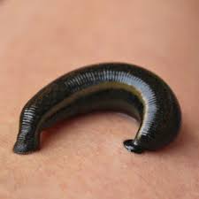 Leech Therapy in Delhi: Possible Benefits and Important Precautions 1 Leech Therapy in Delhi: Possible Benefits and Important Precautions