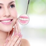 invisalign in norcross