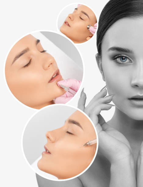 Juvederm Treatment in Dubai 1