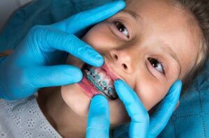 Braces Treatment for Children and Teens: When Is the Right Age? 1 Braces Treatment for Children and Teens: When Is the Right Age?