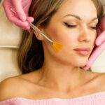Chemical Peels in Riyadh 36