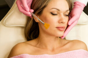 A Beginner’s Guide to Chemical Peels and Skin Health