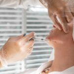 Factors to Consider Before PRP Face Treatment in Dubai
