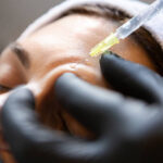 Dermal fillers in Dubai 4
