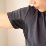 Botox for Sweat Glands in Dubai4