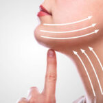 Facelift in Riyadh: Discovering Customized Solutions for Facial Aging 3 Facelift in Riyadh: Discovering Customized Solutions for Facial Aging
