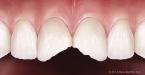 Missing, Damaged or Decayed Teeth? Exploring Modern Restorative Dental Treatment Options 1 Missing, Damaged or Decayed Teeth? Exploring Modern Restorative Dental Treatment Options