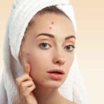 How Acne Scar Treatment Can Improve Skin Texture and Appearance