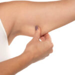 Understanding the Recovery Timeline After Arm Lift Surgery