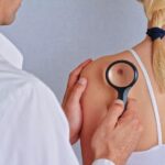 Understanding the Process of Skin Wart Removal in Riyadh 3 Understanding the Process of Skin Wart Removal in Riyadh
