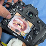Chirurgien-Dentiste Casablanca pour des Soins Dentaires Complets 3 Chirurgien-Dentiste Casablanca pour des Soins Dentaires Complets