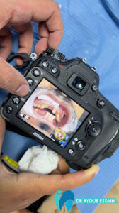 Chirurgien-Dentiste Casablanca pour des Soins Dentaires Complets
