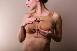 Can Breast Reduction Help With Bra Strap Grooves? 1 Can Breast Reduction Help With Bra Strap Grooves?