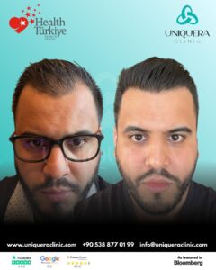 Transforming Confidence: Why Choose UniquEra Clinic for the Best Turkish Hair Transplant