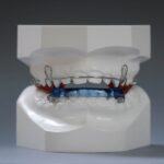 Dental Activators in Dubai6