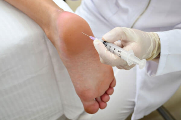 Botox for Foot Sweating in Dubai6
