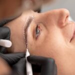 Best Places to Get Brow Lift Surgery in Dubai
