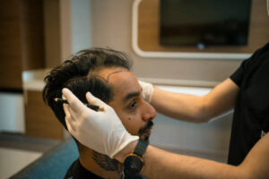 Hybrid Hair Transplant in Dubai: Density vs Donor Supply 1 Hybrid Hair Transplant in Dubai: Density vs Donor Supply