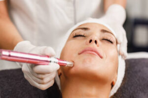 DermaPen for Rosacea-Prone Skin: What You Should Know 1 DermaPen for Rosacea-Prone Skin: What You Should Know