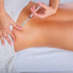 Is Brazilian Butt Lift Suitable for Creating a Fuller, Balanced Figure?