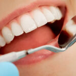 Cosmetic Dentist in Dublin CA: Veneers, Whitening, and Bonding Explained
