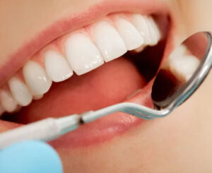 Cosmetic Dentist in Dublin CA: Veneers, Whitening, and Bonding Explained