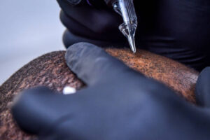 Scalp Micropigmentation in Dubai for Sparse Hair Concerns 1 Scalp Micropigmentation in Dubai for Sparse Hair Concerns