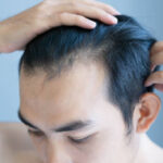 Understanding the Science Behind PRP Hair Treatment in Riyadh 3 Understanding the Science Behind PRP Hair Treatment in Riyadh