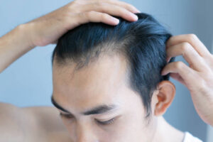 Understanding the Science Behind PRP Hair Treatment in Riyadh 1 Understanding the Science Behind PRP Hair Treatment in Riyadh