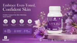 Can Vitiligo Capsules Help With Nutritional Support? Here’s What to Know 1 Can Vitiligo Capsules Help With Nutritional Support? Here’s What to Know