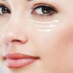 Can Under Eye Fillers Smooth Hollow Areas Under Eyes?