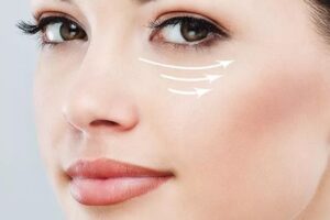 Can Under Eye Fillers Smooth Hollow Areas Under Eyes? 1 Can Under Eye Fillers Smooth Hollow Areas Under Eyes?