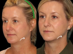 Best Aesthetic Clinics in Dubai for Sculptra Fillers Muscle Loss Rejuvenation 1 Best Aesthetic Clinics in Dubai for Sculptra Fillers Muscle Loss Rejuvenation