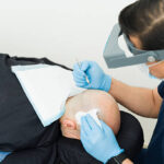 FUE Hair Transplant in Dubai 5