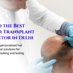 Why Choosing the Right Hair Transplant Surgeon in Delhi Makes All the Difference 3 Why Choosing the Right Hair Transplant Surgeon in Delhi Makes All the Difference