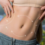 Liposuction Planning: Preparing for Your Body Contouring Procedure