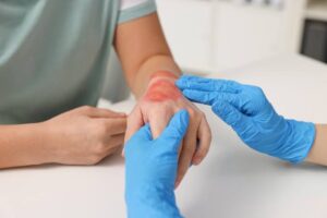 Wound Dressing at Home: Safe Disposal of Used Dressing Materials