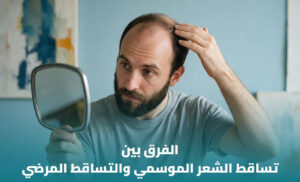 الفرق بين تساقط الشعر الموسمي والمرضي
