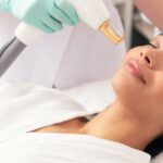 Laser Treatment in Dubai: The Small Print of Light, Skill, and Results 3 Laser Treatment in Dubai: The Small Print of Light, Skill, and Results