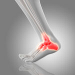 ankle pain 2