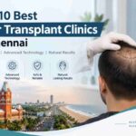 Top 10 Best Hair Transplant Clinics in Chennai