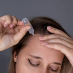 Natural Hairline Treatment in Dubai for Single-Hairline Grafts