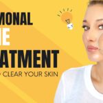 Hormonal Skin Ageing Treatment for Healthier-Looking Skin 3 Hormonal Skin Ageing Treatment for Healthier-Looking Skin