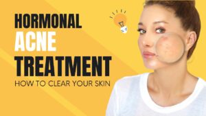 Hormonal Skin Ageing Treatment for Healthier-Looking Skin