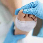 Chronic Wound Management at Home in Michigan Effective Care for Complex Wounds
