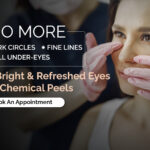 Chemical Peels Explained: Benefits, Types, and What to Expect