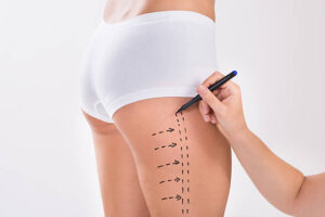 Body Contouring Procedure in Riyadh for a More Defined Shape 1 Body Contouring Procedure in Riyadh for a More Defined Shape