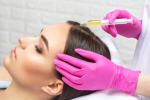PRP Hair Treatment for Scalp Stimulation and Hair Growth